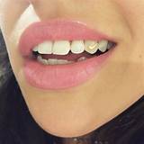 Pictures of Cheap Gold Grill