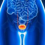 Images of Medication For Interstitial Cystitis Pain