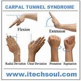 Carpal Tunnel Exercises