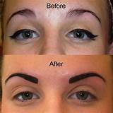 Photos of Eyebrow Permanent Makeup Before And After