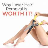 Images of Laser Hair Removal Quotes
