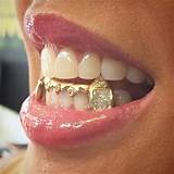 Cheap Gold Grill Pictures