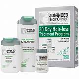 Images of Hair Loss Treatment Prices