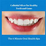 Colloidal Silver And Teeth Photos