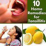 Tonsils Infection Home Remedies
