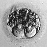 Photos of Day 6 Frozen Embryo Transfer Success Rates