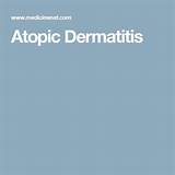 Atopic Dermatitis Medications Treatment