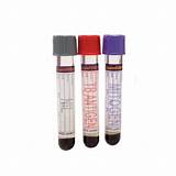 Pictures of Quantiferon Tb Gold Blood Test Positive