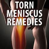 Images of Torn Meniscus Home Remedies