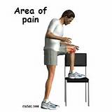 Pictures of Exercises Knee Bursitis