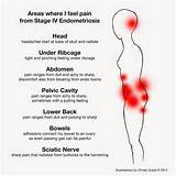 Gas Pain Areas Images