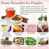 Acne Clearing Home Remedies Pictures