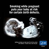 Photos of Smoking Cigarettes While Pregnant Side Effects