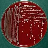 Pictures of Antibiotic Treatment For Klebsiella Pneumoniae Uti