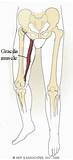 Gracilis Muscle Exercise Images