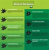 Weed Side Effects Good
