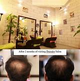 Salon Hair Growth Treatment Photos