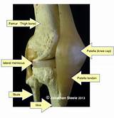 Images of A Knee Doctor Is Called