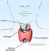 What Doctor To See For Hypothyroidism Photos