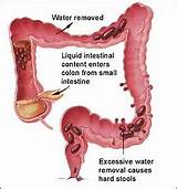 Constipation And Passing Gas