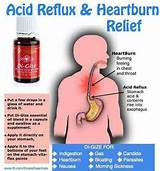Photos of Gas X And Acid Reflux
