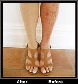 How To Cover Up Scars On Legs With Makeup Images