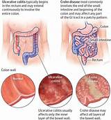 Crohn''s Doctor Pictures