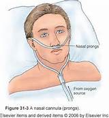 Images of Low Flow Oxygen Therapy