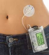 What Is An Insulin Pump Photos