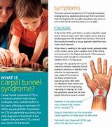 What Doctor Do I See For Carpal Tunnel Syndrome Pictures