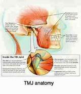 Photos of Jaw Muscle Exercises Tmj