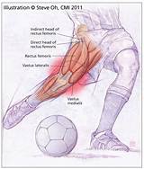 Images of Torn Thigh Muscle Recovery Time