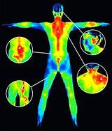 Images of Thermal Imaging Medical Diagnosis
