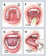 Hpv Oral Medication Images