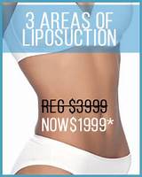 Images of Best Liposuction Doctors In South Florida