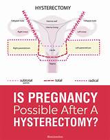 What Is The Recovery Time For A Total Hysterectomy