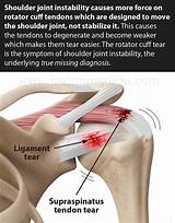 Rotator Cuff Recovery Time Images