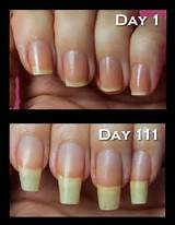 Best Nail Repair After Acrylics Pictures