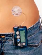 What Is An Insulin Pump Pictures