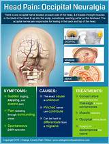 Images of Ms And Headaches Treatment