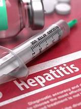 Doctors And Medical Specialists For Hepatitis B Pictures
