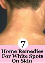 Home Remedies For Beautiful Skin In Summer Photos