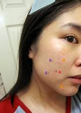 Makeup That Covers Pimples