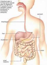 Pictures of What Causes Intestinal Gas Pain