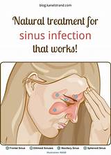 Images of Houston Sinus Treatment