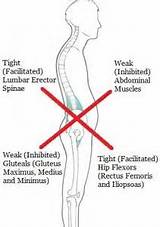 Lower Back Pain Weak Core Muscles Images