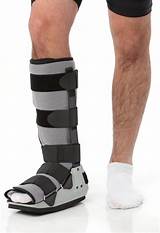 Foot Fracture Surgery Recovery Time Images