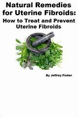 Home Remedies For Shrinking Fibroids Images