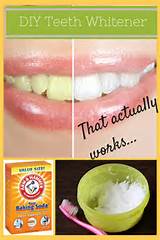 Make Teeth Whiter Home Remedies Images
