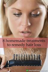 Images of Hair Loss Reasons And Natural Treatments